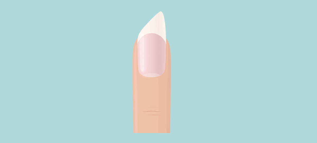 Illustration eines Fingers mit angeschrägtem Fingernagel