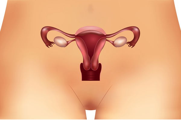 PCO-Syndrom: Symptome, Ursachen und Behandlung der hormonellen Störung