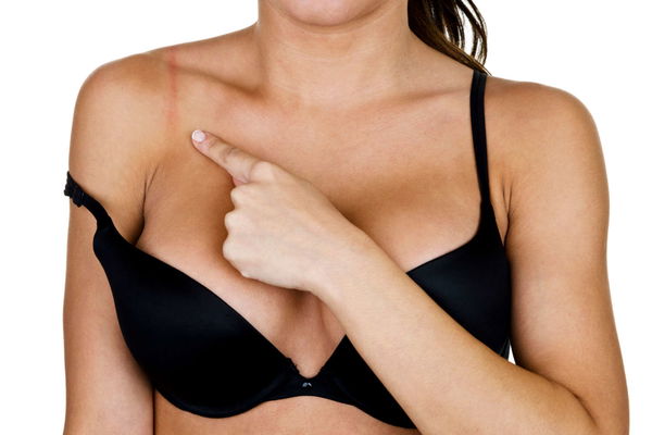 Warum Frauen besser auf einen BH verzichten sollten